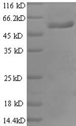 (Tris-Glycine gel) Discontinuous SDS-PAGE (reduced) with 5% enrichment gel and 15% separation gel. (Tris-Glycine gel) Discontinuous SDS-PAGE (reduced) with 5% enrichment gel and 15% separation gel.