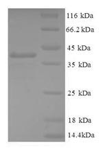 (Tris-Glycine gel) Discontinuous SDS-PAGE (reduced) with 5% enrichment gel and 15% separation gel. (Tris-Glycine gel) Discontinuous SDS-PAGE (reduced) with 5% enrichment gel and 15% separation gel.