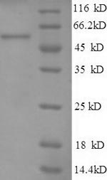 (Tris-Glycine gel) Discontinuous SDS-PAGE (reduced) with 5% enrichment gel and 15% separation gel. (Tris-Glycine gel) Discontinuous SDS-PAGE (reduced) with 5% enrichment gel and 15% separation gel.