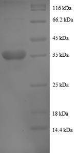 (Tris-Glycine gel) Discontinuous SDS-PAGE (reduced) with 5% enrichment gel and 15% separation gel. (Tris-Glycine gel) Discontinuous SDS-PAGE (reduced) with 5% enrichment gel and 15% separation gel.