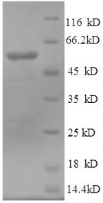 Recombinant Human Tubulin beta-3 chain (TUBB3) , partial - image 1