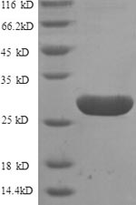 (Tris-Glycine gel) Discontinuous SDS-PAGE (reduced) with 5% enrichment gel and 15% separation gel. (Tris-Glycine gel) Discontinuous SDS-PAGE (reduced) with 5% enrichment gel and 15% separation gel.