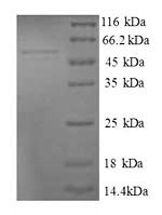 (Tris-Glycine gel) Discontinuous SDS-PAGE (reduced) with 5% enrichment gel and 15% separation gel. (Tris-Glycine gel) Discontinuous SDS-PAGE (reduced) with 5% enrichment gel and 15% separation gel.