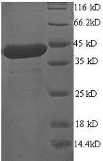 (Tris-Glycine gel) Discontinuous SDS-PAGE (reduced) with 5% enrichment gel and 15% separation gel. (Tris-Glycine gel) Discontinuous SDS-PAGE (reduced) with 5% enrichment gel and 15% separation gel.