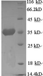 SDS-PAGE- Recombinant protein Human HSPA5