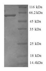 (Tris-Glycine gel) Discontinuous SDS-PAGE (reduced) with 5% enrichment gel and 15% separation gel. (Tris-Glycine gel) Discontinuous SDS-PAGE (reduced) with 5% enrichment gel and 15% separation gel.