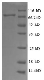 (Tris-Glycine gel) Discontinuous SDS-PAGE (reduced) with 5% enrichment gel and 15% separation gel. (Tris-Glycine gel) Discontinuous SDS-PAGE (reduced) with 5% enrichment gel and 15% separation gel.