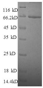 (Tris-Glycine gel) Discontinuous SDS-PAGE (reduced) with 5% enrichment gel and 15% separation gel. (Tris-Glycine gel) Discontinuous SDS-PAGE (reduced) with 5% enrichment gel and 15% separation gel.