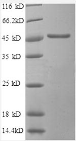 (Tris-Glycine gel) Discontinuous SDS-PAGE (reduced) with 5% enrichment gel and 15% separation gel. (Tris-Glycine gel) Discontinuous SDS-PAGE (reduced) with 5% enrichment gel and 15% separation gel.
