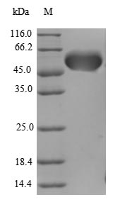 (Tris-Glycine gel) Discontinuous SDS-PAGE (reduced) with 5% enrichment gel and 15% separation gel. (Tris-Glycine gel) Discontinuous SDS-PAGE (reduced) with 5% enrichment gel and 15% separation gel.