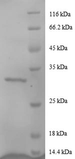 Recombinant Human Agouti-related protein (AGRP) - image 1