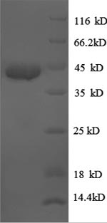 (Tris-Glycine gel) Discontinuous SDS-PAGE (reduced) with 5% enrichment gel and 15% separation gel.