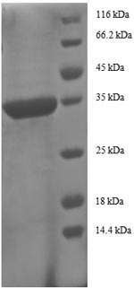 (Tris-Glycine gel) Discontinuous SDS-PAGE (reduced) with 5% enrichment gel and 15% separation gel. (Tris-Glycine gel) Discontinuous SDS-PAGE (reduced) with 5% enrichment gel and 15% separation gel.