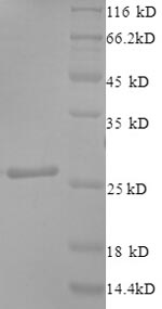 SDS-PAGE- Recombinant protein Human CNTF