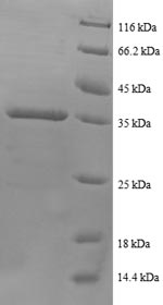 (Tris-Glycine gel) Discontinuous SDS-PAGE (reduced) with 5% enrichment gel and 15% separation gel. (Tris-Glycine gel) Discontinuous SDS-PAGE (reduced) with 5% enrichment gel and 15% separation gel.