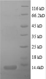 (Tris-Glycine gel) Discontinuous SDS-PAGE (reduced) with 5% enrichment gel and 15% separation gel. (Tris-Glycine gel) Discontinuous SDS-PAGE (reduced) with 5% enrichment gel and 15% separation gel.