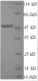 (Tris-Glycine gel) Discontinuous SDS-PAGE (reduced) with 5% enrichment gel and 15% separation gel. (Tris-Glycine gel) Discontinuous SDS-PAGE (reduced) with 5% enrichment gel and 15% separation gel.