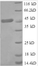 (Tris-Glycine gel) Discontinuous SDS-PAGE (reduced) with 5% enrichment gel and 15% separation gel. (Tris-Glycine gel) Discontinuous SDS-PAGE (reduced) with 5% enrichment gel and 15% separation gel.