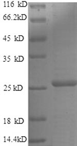 (Tris-Glycine gel) Discontinuous SDS-PAGE (reduced) with 5% enrichment gel and 15% separation gel. (Tris-Glycine gel) Discontinuous SDS-PAGE (reduced) with 5% enrichment gel and 15% separation gel.