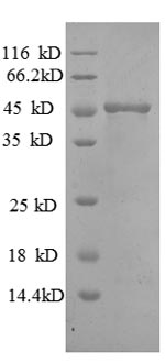 (Tris-Glycine gel) Discontinuous SDS-PAGE (reduced) with 5% enrichment gel and 15% separation gel. (Tris-Glycine gel) Discontinuous SDS-PAGE (reduced) with 5% enrichment gel and 15% separation gel.