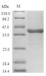 SDS-PAGE- Recombinant protein Human VEGFC