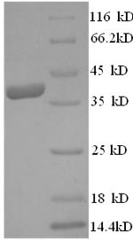 SDS-PAGE- Recombinant protein Human FIGF