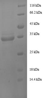 (Tris-Glycine gel) Discontinuous SDS-PAGE (reduced) with 5% enrichment gel and 15% separation gel. (Tris-Glycine gel) Discontinuous SDS-PAGE (reduced) with 5% enrichment gel and 15% separation gel.