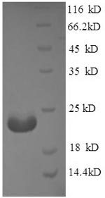 Recombinant Mouse Adiponectin (Adipoq) , partial - image 1
