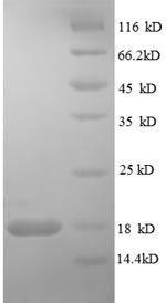 (Tris-Glycine gel) Discontinuous SDS-PAGE (reduced) with 5% enrichment gel and 15% separation gel. (Tris-Glycine gel) Discontinuous SDS-PAGE (reduced) with 5% enrichment gel and 15% separation gel.