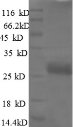 (Tris-Glycine gel) Discontinuous SDS-PAGE (reduced) with 5% enrichment gel and 15% separation gel. (Tris-Glycine gel) Discontinuous SDS-PAGE (reduced) with 5% enrichment gel and 15% separation gel.