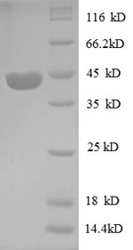 SDS-PAGE- Recombinant protein Human PP1446