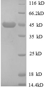 (Tris-Glycine gel) Discontinuous SDS-PAGE (reduced) with 5% enrichment gel and 15% separation gel. (Tris-Glycine gel) Discontinuous SDS-PAGE (reduced) with 5% enrichment gel and 15% separation gel.