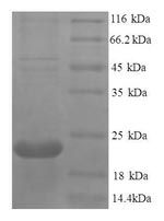 SDS-PAGE- Recombinant protein Human TNFRSF11A