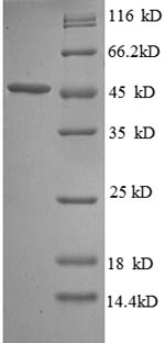 (Tris-Glycine gel) Discontinuous SDS-PAGE (reduced) with 5% enrichment gel and 15% separation gel. (Tris-Glycine gel) Discontinuous SDS-PAGE (reduced) with 5% enrichment gel and 15% separation gel.