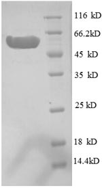 (Tris-Glycine gel) Discontinuous SDS-PAGE (reduced) with 5% enrichment gel and 15% separation gel. (Tris-Glycine gel) Discontinuous SDS-PAGE (reduced) with 5% enrichment gel and 15% separation gel.