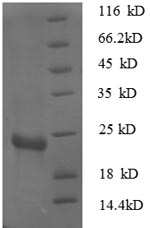 (Tris-Glycine gel) Discontinuous SDS-PAGE (reduced) with 5% enrichment gel and 15% separation gel. (Tris-Glycine gel) Discontinuous SDS-PAGE (reduced) with 5% enrichment gel and 15% separation gel.