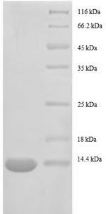 (Tris-Glycine gel) Discontinuous SDS-PAGE (reduced) with 5% enrichment gel and 15% separation gel. (Tris-Glycine gel) Discontinuous SDS-PAGE (reduced) with 5% enrichment gel and 15% separation gel.