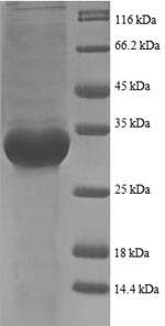 (Tris-Glycine gel) Discontinuous SDS-PAGE (reduced) with 5% enrichment gel and 15% separation gel. (Tris-Glycine gel) Discontinuous SDS-PAGE (reduced) with 5% enrichment gel and 15% separation gel.