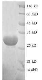 (Tris-Glycine gel) Discontinuous SDS-PAGE (reduced) with 5% enrichment gel and 15% separation gel. (Tris-Glycine gel) Discontinuous SDS-PAGE (reduced) with 5% enrichment gel and 15% separation gel.