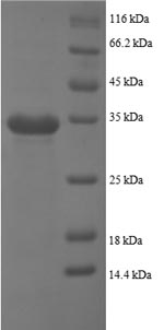 SDS-PAGE- Recombinant protein Human PPBP