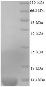 (Tris-Glycine gel) Discontinuous SDS-PAGE (reduced) with 5% enrichment gel and 15% separation gel. (Tris-Glycine gel) Discontinuous SDS-PAGE (reduced) with 5% enrichment gel and 15% separation gel.