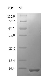 (Tris-Glycine gel) Discontinuous SDS-PAGE (reduced) with 5% enrichment gel and 15% separation gel. (Tris-Glycine gel) Discontinuous SDS-PAGE (reduced) with 5% enrichment gel and 15% separation gel.