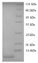 (Tris-Glycine gel) Discontinuous SDS-PAGE (reduced) with 5% enrichment gel and 15% separation gel. (Tris-Glycine gel) Discontinuous SDS-PAGE (reduced) with 5% enrichment gel and 15% separation gel.