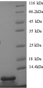 (Tris-Glycine gel) Discontinuous SDS-PAGE (reduced) with 5% enrichment gel and 15% separation gel. (Tris-Glycine gel) Discontinuous SDS-PAGE (reduced) with 5% enrichment gel and 15% separation gel.