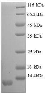 (Tris-Glycine gel) Discontinuous SDS-PAGE (reduced) with 5% enrichment gel and 15% separation gel. (Tris-Glycine gel) Discontinuous SDS-PAGE (reduced) with 5% enrichment gel and 15% separation gel.