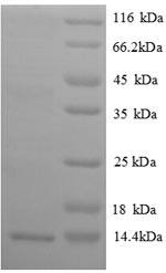 (Tris-Glycine gel) Discontinuous SDS-PAGE (reduced) with 5% enrichment gel and 15% separation gel. (Tris-Glycine gel) Discontinuous SDS-PAGE (reduced) with 5% enrichment gel and 15% separation gel.