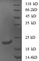 (Tris-Glycine gel) Discontinuous SDS-PAGE (reduced) with 5% enrichment gel and 15% separation gel. (Tris-Glycine gel) Discontinuous SDS-PAGE (reduced) with 5% enrichment gel and 15% separation gel.