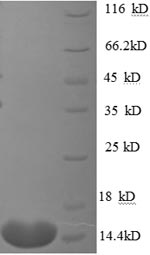 (Tris-Glycine gel) Discontinuous SDS-PAGE (reduced) with 5% enrichment gel and 15% separation gel. (Tris-Glycine gel) Discontinuous SDS-PAGE (reduced) with 5% enrichment gel and 15% separation gel.