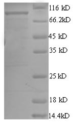 (Tris-Glycine gel) Discontinuous SDS-PAGE (reduced) with 5% enrichment gel and 15% separation gel. (Tris-Glycine gel) Discontinuous SDS-PAGE (reduced) with 5% enrichment gel and 15% separation gel.