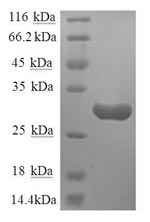 SDS-PAGE- Recombinant protein Human TACR1